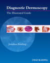 Diagnostic Dermoscopy. The Illustrated Guide