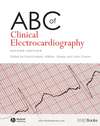 ABC of Clinical Electrocardiography