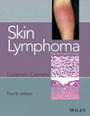 Skin Lymphoma