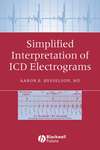 Simplified Interpretation of ICD Electrograms