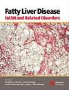 Fatty Liver Disease