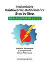 Implantable Cardioverter - Defibrillators Step by Step