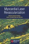 Myocardial Laser Revascularization