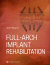 Full-Arch Implant Rehabilitation