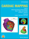 Cardiac Mapping