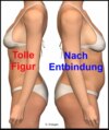 Tolle Figur – Nach Entbindung