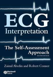 ECG Interpretation