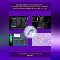 Дарья Юрьевна Венидиктова. Инструментальная диагностика и мониторинг немедикаментозного лечения неалкогольной жировой болезни печени