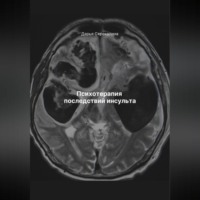 Дарья Владимировна Стрекалина. Психотерапия последствий инсульта