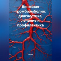 . Венозная тромбоэмболия: диагностика, лечение и профилактика
