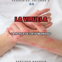 . La Viruela