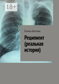 Реципиент (реальная история)