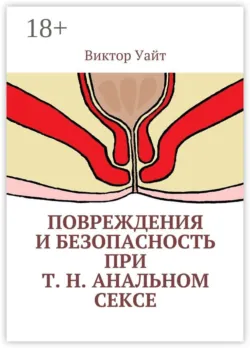 Повреждения и безопасность при т. н. анальном сексе - Виктор Уайт