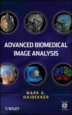 Advanced Biomedical Image Analysis - Mark Haidekker Advanced Biomedical Image Analysis - Mark Haidekker