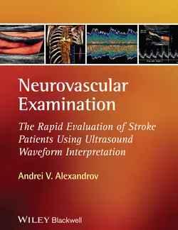 Neurovascular Examination. The Rapid Evaluation of Stroke Patients Using Ultrasound Waveform Interpretation - Andrei Alexandrov Neurovascular Examination. The Rapid Evaluation of Stroke Patients Using Ultrasound Waveform Interpretation - Andrei Alexandrov