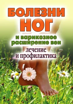 Болезни ног и варикозное расширение вен. Лечение и профилактика - Сборник