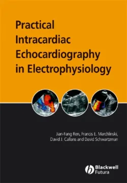 Practical Intracardiac Echocardiography in Electrophysiology - Jian-Fang Ren