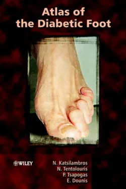 Atlas of the Diabetic Foot - Nicholas Katsilambros