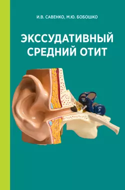Экссудативный средний отит, Мария Бобошко