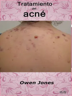 Tratamiento Del Acné - Owen Jones