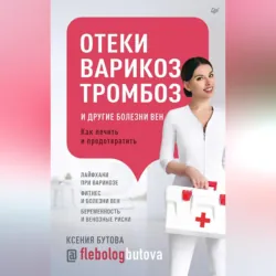 Отеки, варикоз, тромбоз и другие болезни вен. Как лечить и предотвратить - Ксения Бутова