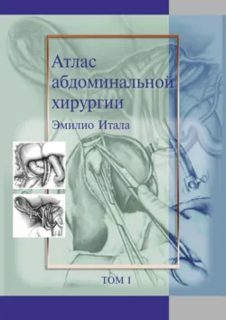 Атлас абдоминальной хирургии. Том 1. Хирургия печени, желчных путей, поджелудочной железы и портальной системы - Эмилио Итала