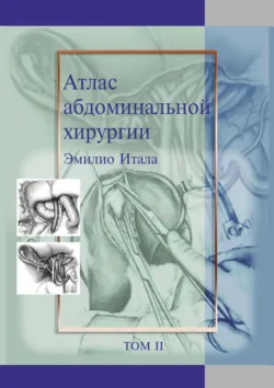 Атлас абдоминальной хирургии. Том 2. Хирургия желудка и двенадцатиперстной кишки - Эмилио Итала
