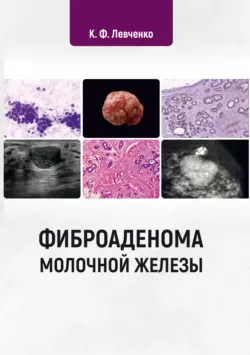 Филогенетическая теория общей патологии. Патогенез метаболических пандемий. Сахарный диабет, аудиокнига . ISDN71179627