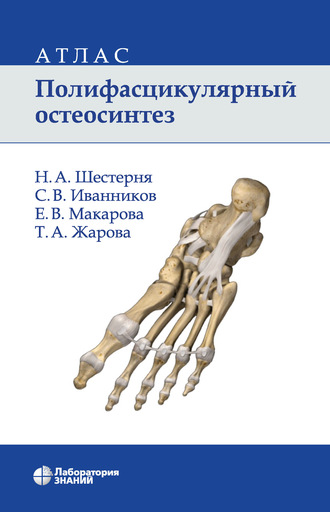 Н. А. Шестерня. Полифасцикулярный остеосинтез. Атлас