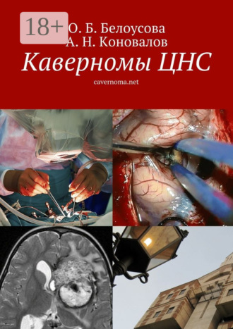 Обложка книги «Каверномы ЦНС. cavernoma.net»