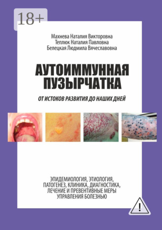 Обложка книги «Аутоиммунная пузырчатка. От истоков развития до наших дней»