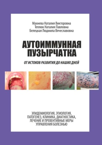 Наталия Викторовна Махнева. Аутоиммунная пузырчатка. От истоков развития до наших дней