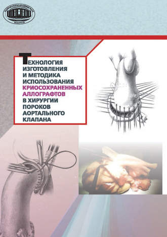 Обложка книги «Технология изготовления и методика использования криосохраненных аллографтов в хирургии пороков аортального клапана»