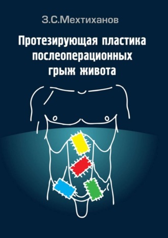 Зубаир Селимович Мехтиханов. Протезирующая пластика послеоперационных грыж живота