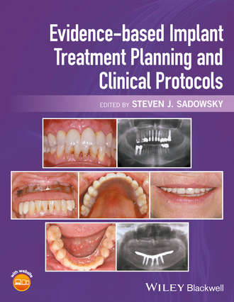 Группа авторов. Evidence-based Implant Treatment Planning and Clinical Protocols