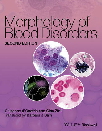 Giuseppe d'Onofrio. Morphology of Blood Disorders