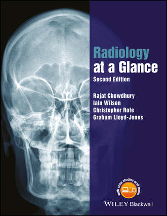 Rajat Chowdhury. Radiology at a Glance