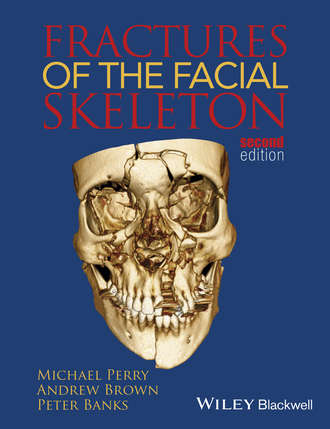 Andrew  Brown. Fractures of the Facial Skeleton