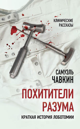 Обложка книги «Похитители разума. Краткая история лоботомии»