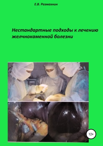 Обложка книги «Нестандартные подходы к лечению желчнокаменной болезни»