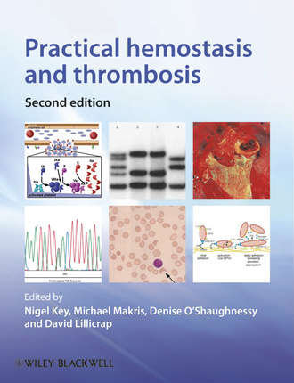 Michael  Makris. Practical Hemostasis and Thrombosis