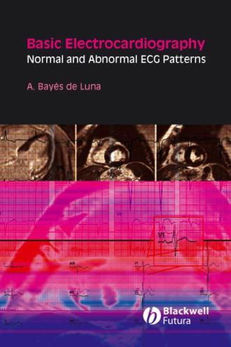 Группа авторов. Basic Electrocardiography