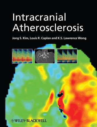 Jong Kim S.. Intracranial Atherosclerosis