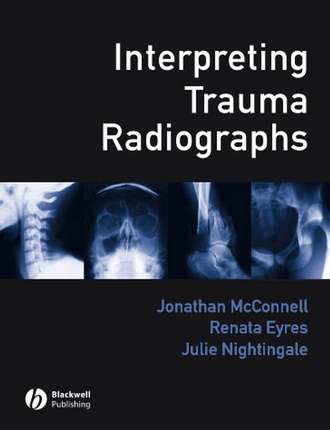 Jonathan  McConnell. Interpreting Trauma Radiographs