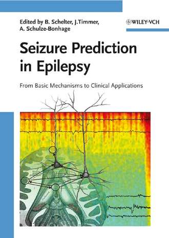 Jens  Timmer. Seizure Prediction in Epilepsy