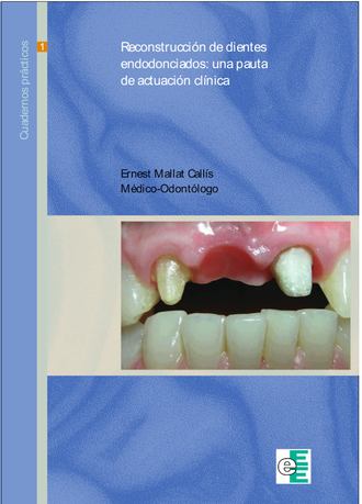 Ernest Mallat Call?s. Reconstrucci?n de dientes endodonciados