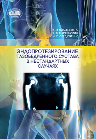 Обложка книги «Эндопротезирование тазобедренного сустава в нестандартных случаях»