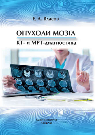 Обложка книги «Опухоли мозга. КТ- и МРТ-диагностика»