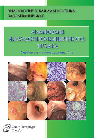 Обложка книги «Лимфомы желудочно-кишечного тракта»