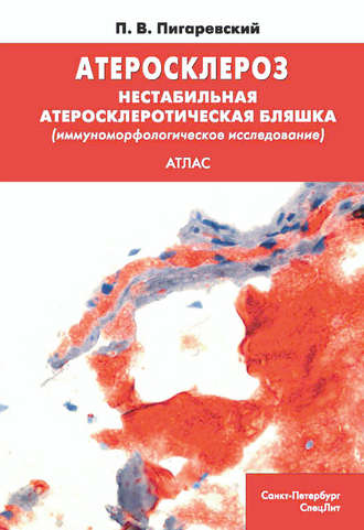 Обложка книги «Атеросклероз. Нестабильная атеросклеротическая бляшка (иммуноморфологическое исследование)»